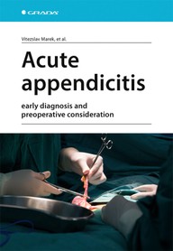 E-kniha Acute appendicitis