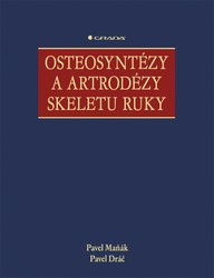 E-kniha Osteosyntézy a artrodézy skeletu ruky