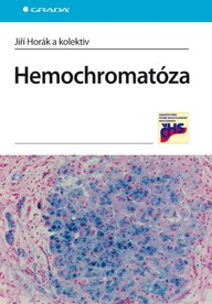 E-kniha Hemochromatóza