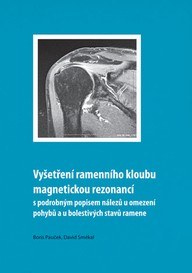 E-kniha Vyšetření ramenního kloubu magnetickou rezonancí s podrobným popisem nálezů u omezení pohybů u bolestivých stavů ramene