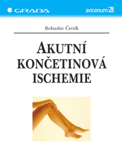 E-kniha Akutní končetinová ischemie
