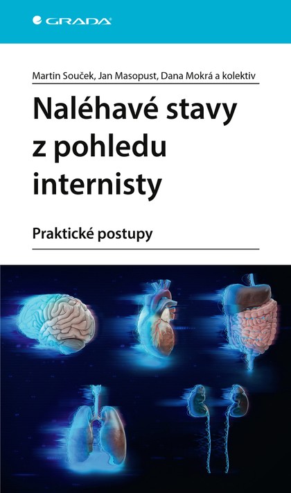 E-kniha Naléhavé stavy z pohledu internisty