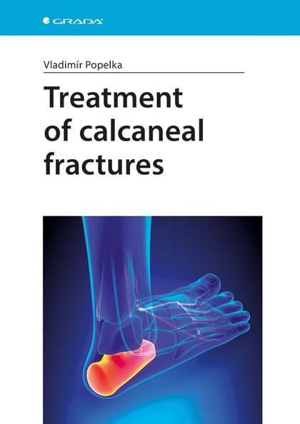 E-kniha Treatment of calcaneal fractures