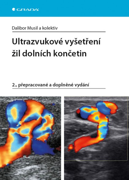 E-kniha Ultrazvukové vyšetření žil dolních končetin