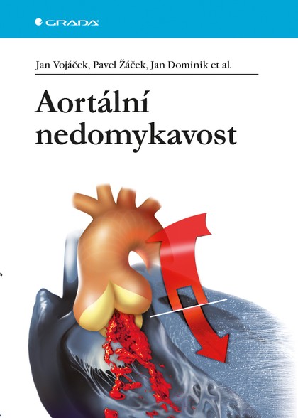 E-kniha Aortální nedomykavost