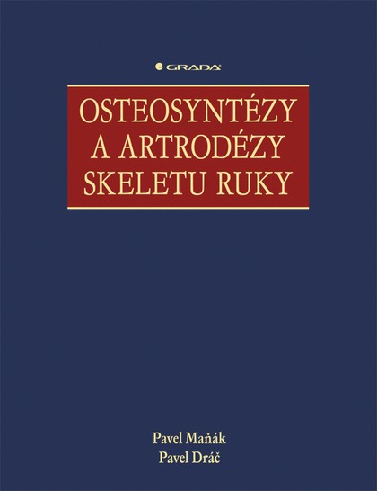 E-kniha Osteosyntézy a artrodézy skeletu ruky
