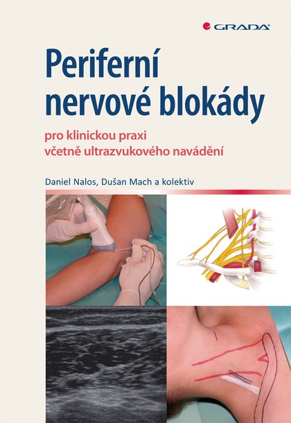 E-kniha Periferní nervové blokády