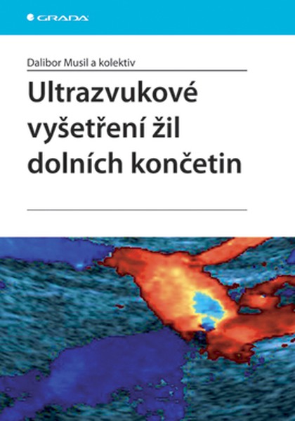 E-kniha Ultrazvukové vyšetření žil dolních končetin