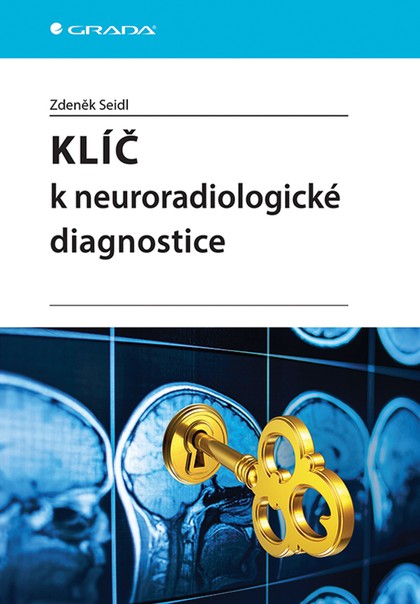 E-kniha Klíč k neuroradiologické diagnostice