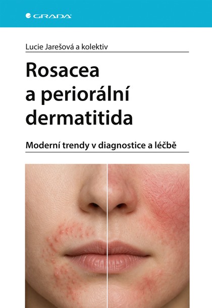 E-kniha Rosacea a periorální dermatitida - Moderní trendy v diagnostice a léčbě